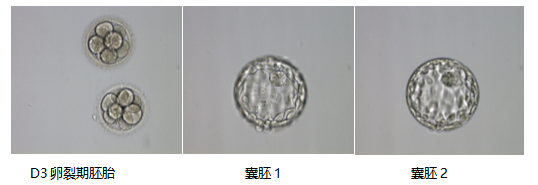 囊胚评级AA就一定最好吗？4AA和6AA囊胚哪个更好？一文读懂囊胚评级背后的秘密！