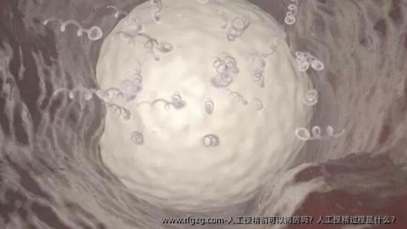 人工授精前可以同房吗？人工授精过程是什么？ 