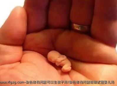 染色体有问题可以生孩子吗?染色体有问题能做代孕吗
