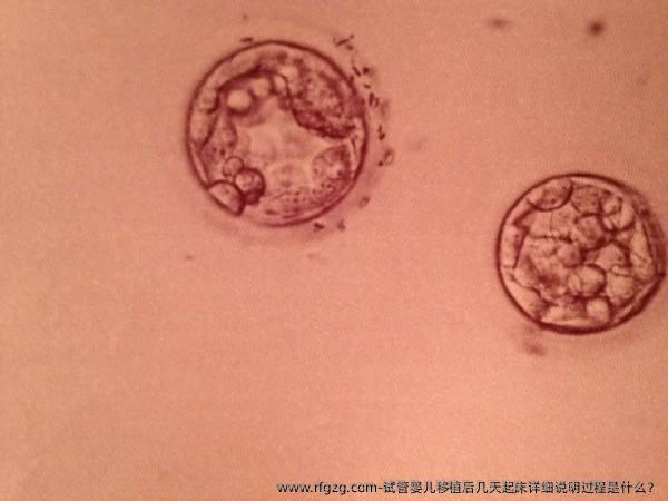 代孕移植后几天起床详细说明过程是什么？