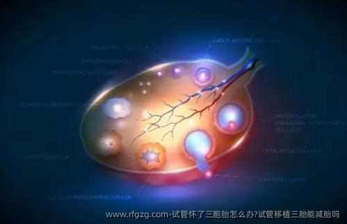 试管怀了三胞胎怎么办?试管移植三胎能减胎吗
