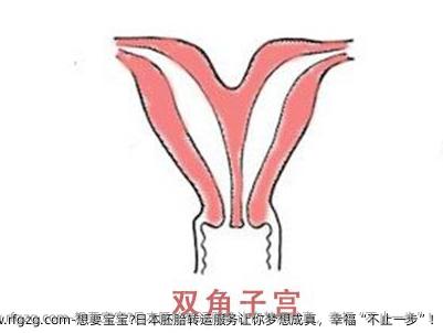 想要宝宝?日本胚胎转运服务让你梦想成真，幸福“不止一步”!