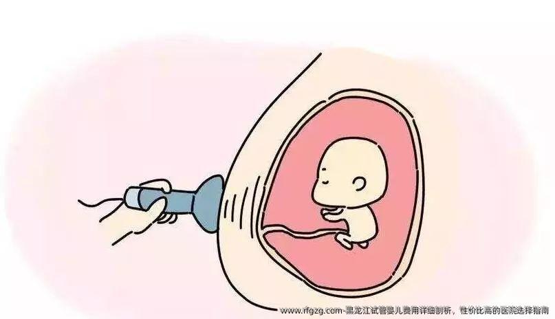黑龙江试管婴儿费用详细剖析，性价比高的医院选择指南