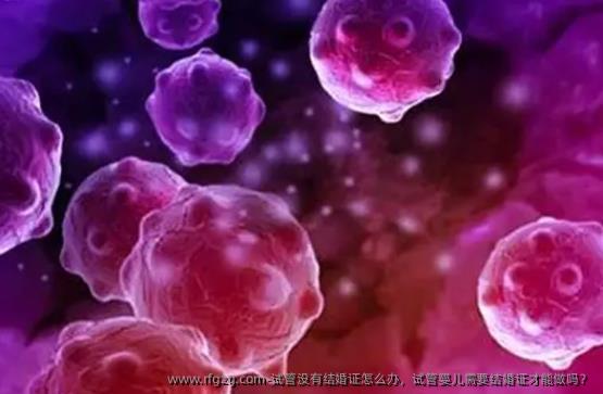 试管没有结婚证怎么办，代孕需要结婚证才能做吗？