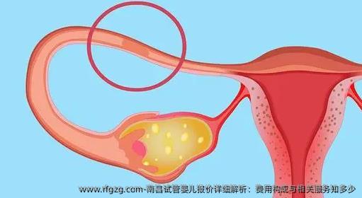 南昌代孕报价详细解析：费用构成与相关服务知多少