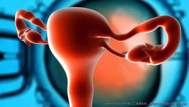 做人工授精失败，是精子质量问题还是卵子质量 